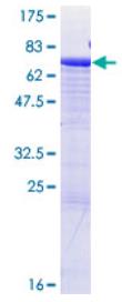 SDS-PAGE (CD177-0730H).jpg